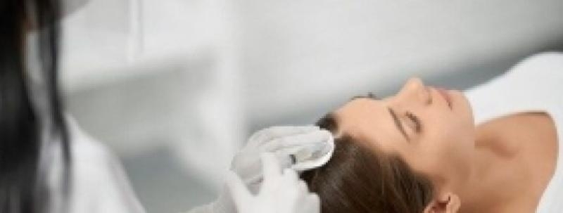 Intradermoterapia Capilar